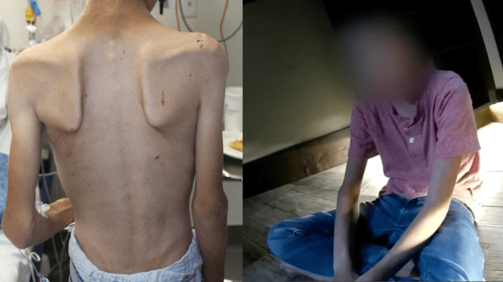 Image of Ruby Frankie’s youngest son with protruding shoulder blades, showing his back. Ruby’s younger daughter sits crisscross on the hardwood floor, her face blurred for privacy.